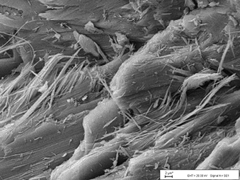 Figure 3b Scanning electron micrograph of fibres of antigorite released by gentle grinding of serpentinite fragment arrowed in 3(a). (Image courtesy of W Vortisch)